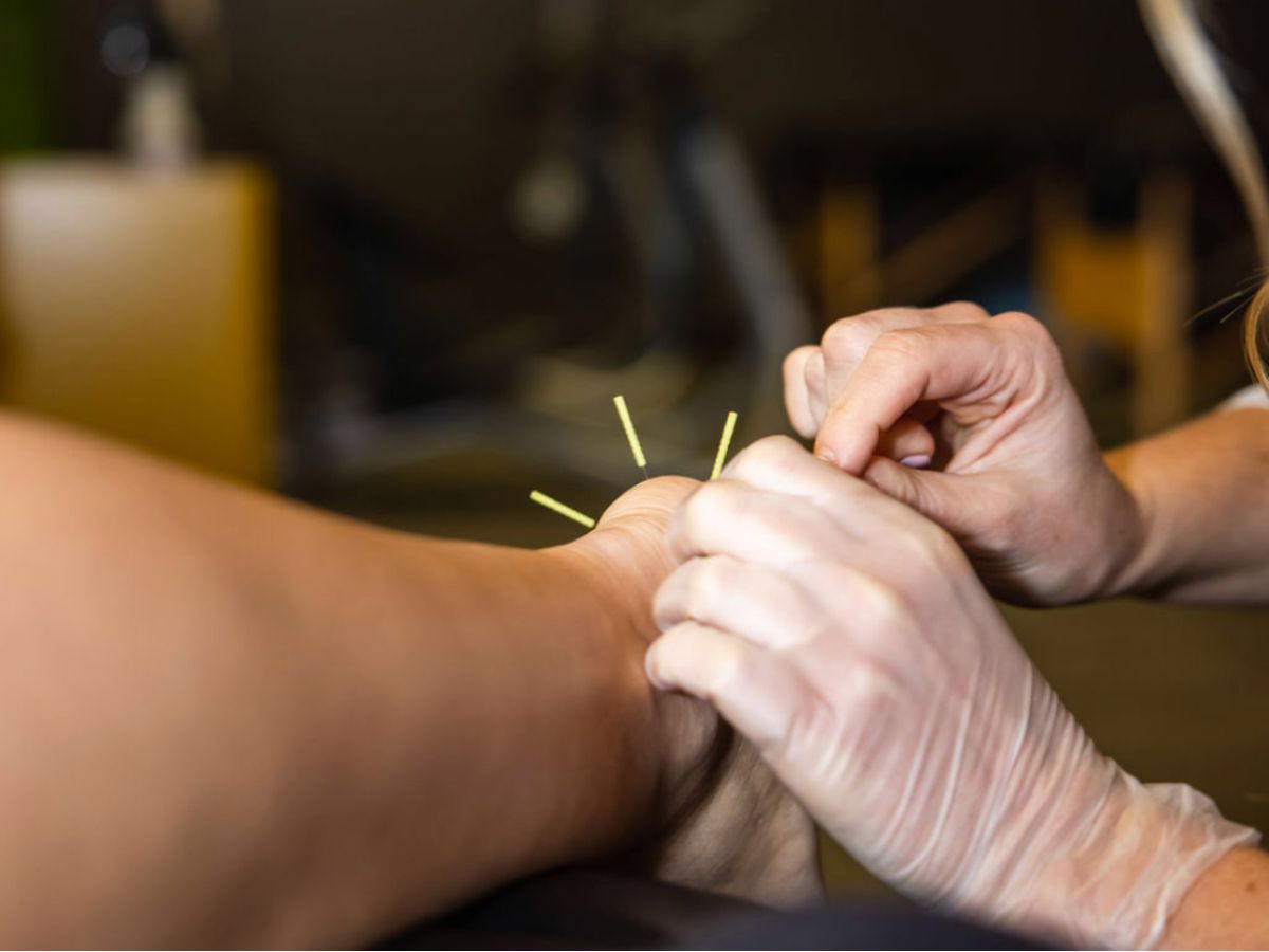 Naperville acupuncture: Powerful Pain Relief That Lasts