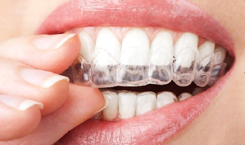 Orthodontist Near By Me: 7 Positive Ways to Health