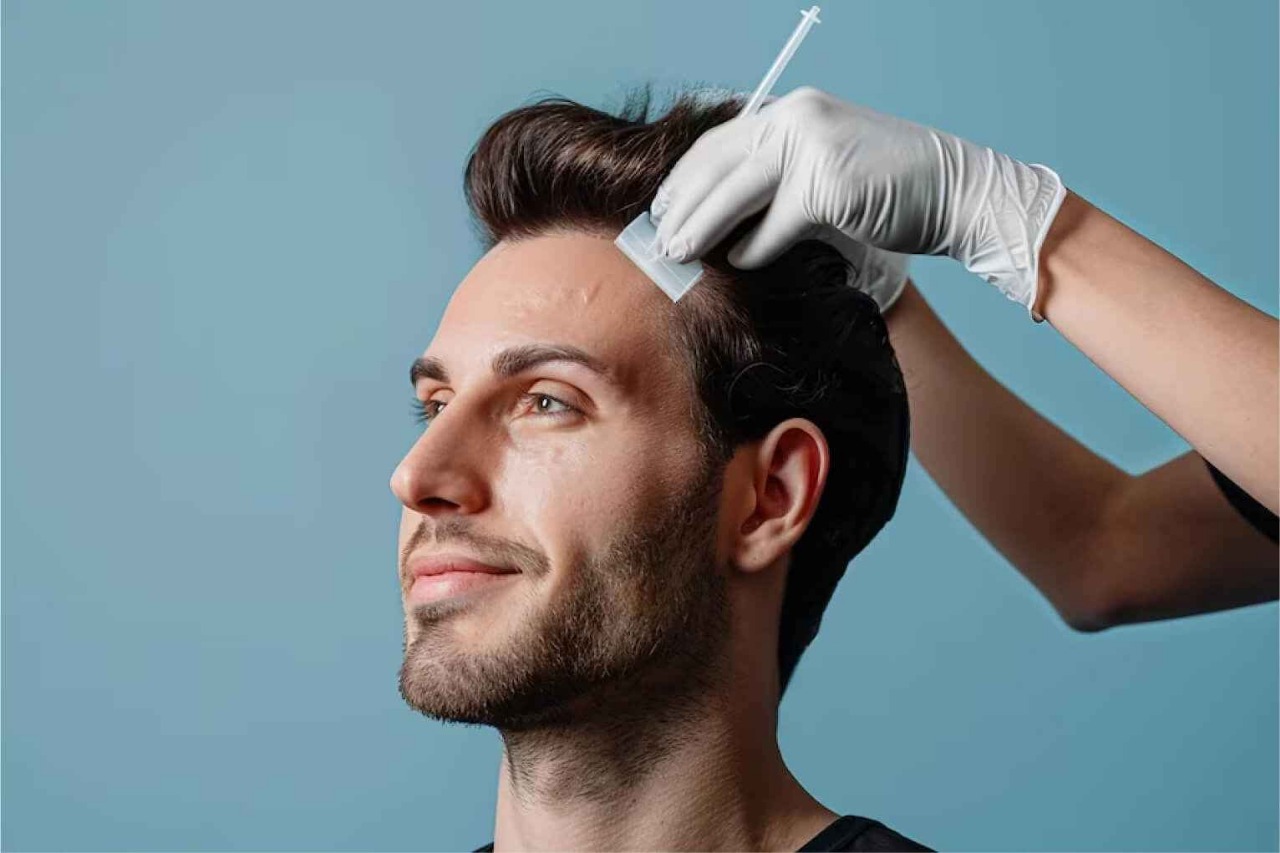 Hair Transplant Birmingham – Regain Confidence Instantly