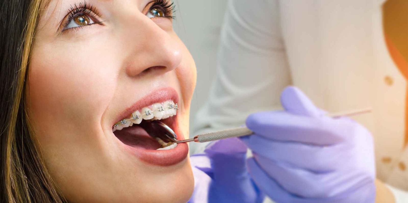 best braces treatment in hawthorn vic